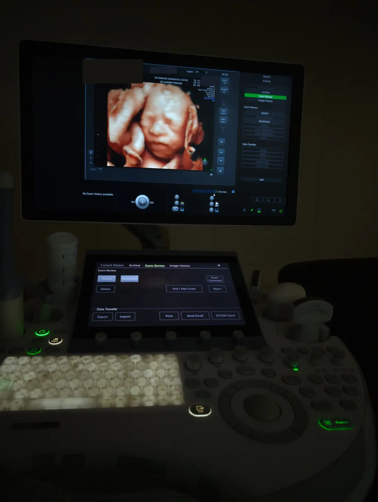 The ultrasound console at the centre, with a 3D image on the monitor