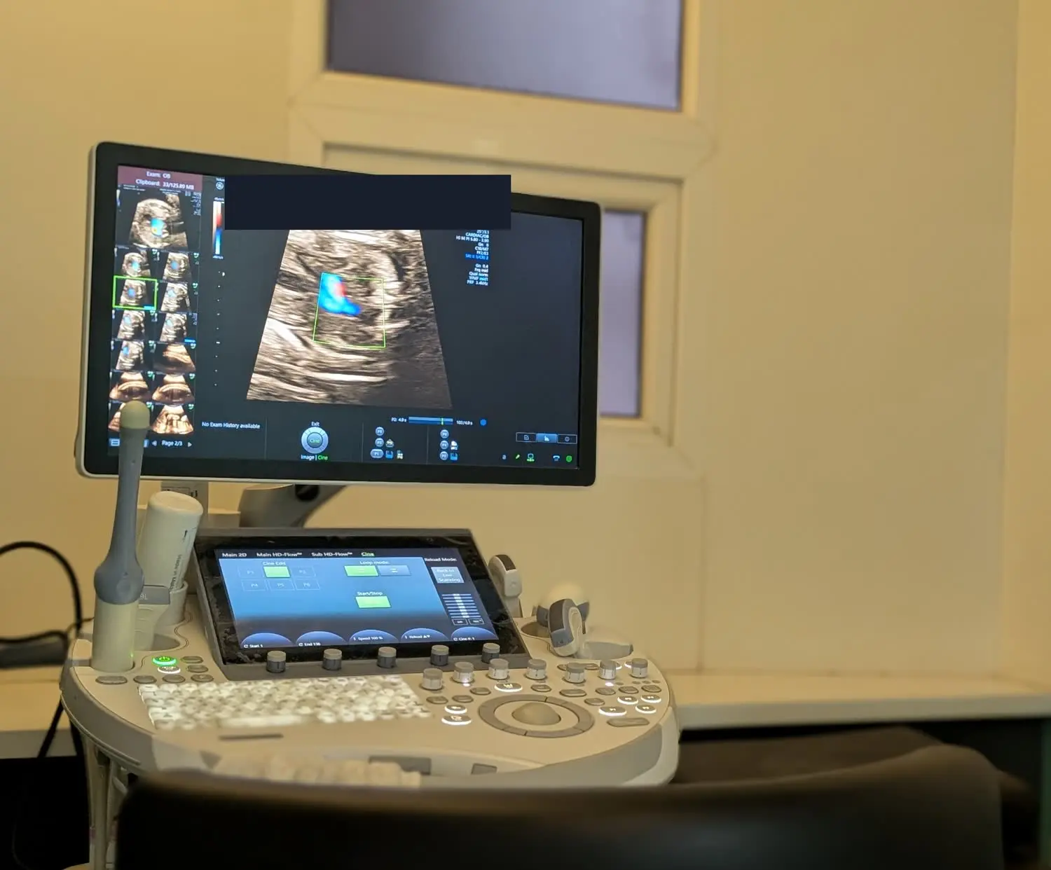 A colour Doppler study displayed on the Voluson system at the centre